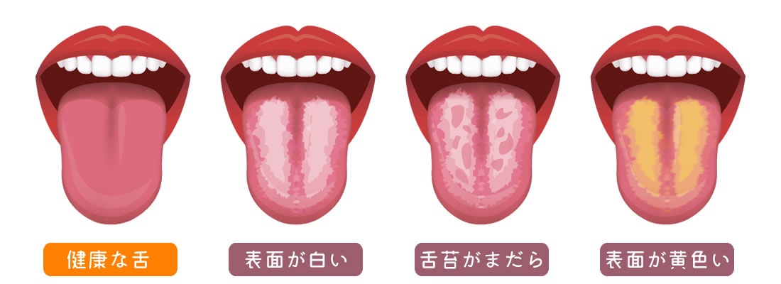 舌の学校
